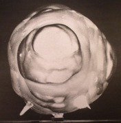 Contest For Supremacy