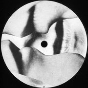 1996